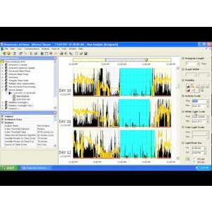 philips respironics software download