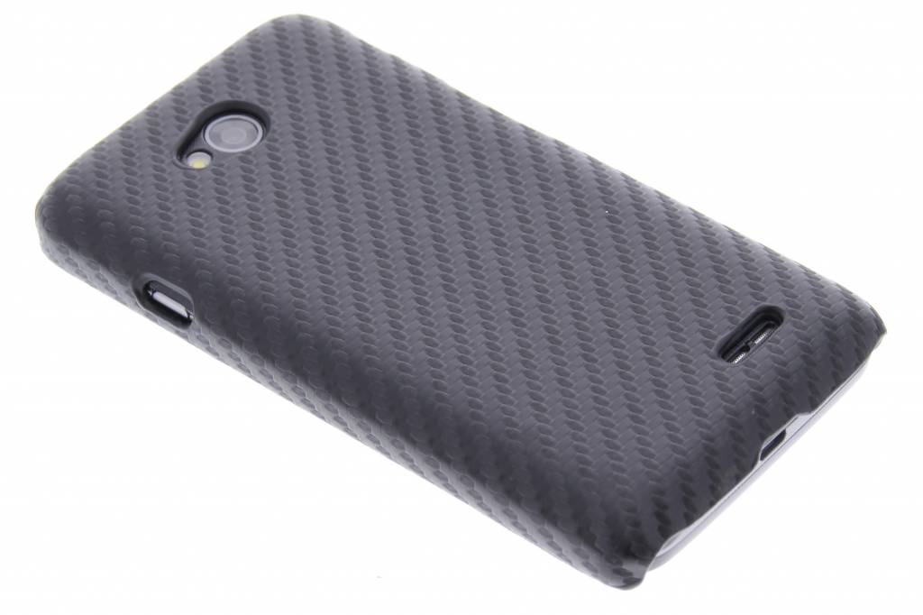 Image of Zwart carbon look hardcase hoesje voor de LG L70