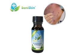 Saniskin Tag Remover