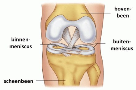 Meniscus kniebrace kopen?
