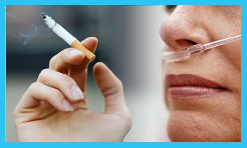 Smoking and oxygen therapy