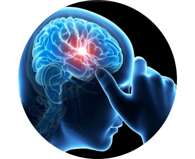 Kunnen voedingssupplementen migraine verlichten?