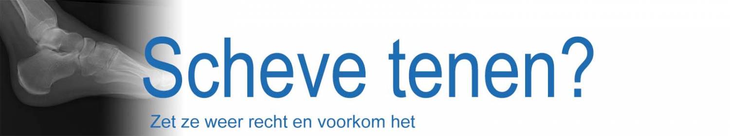 Scheve en scheefgroeiende tenen