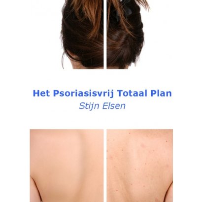 Het psoriasisvrij totaal plan (5de druk) - Stijn Elsen