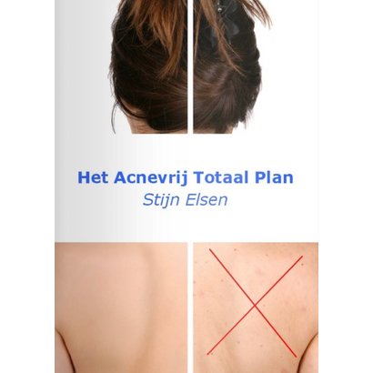Het Acnevrij Totaal Plan - Stijn Elsen