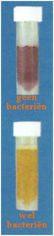 uitslag coliform test