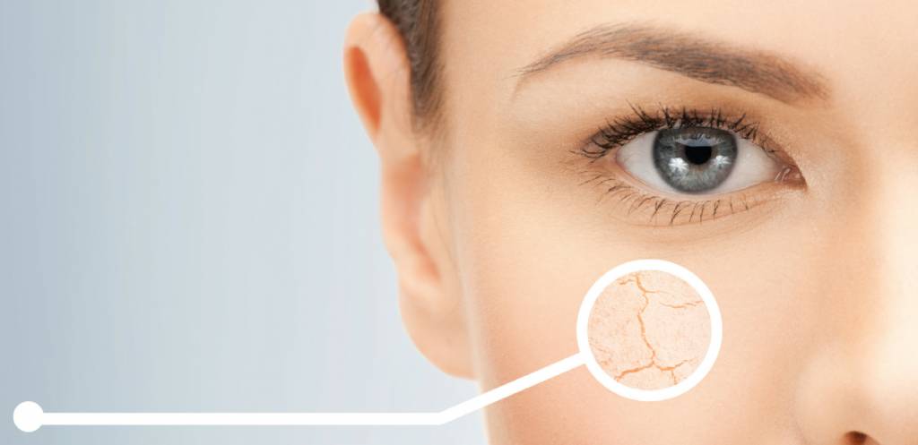 Niacinamide: een wonderstofje voor je huid
