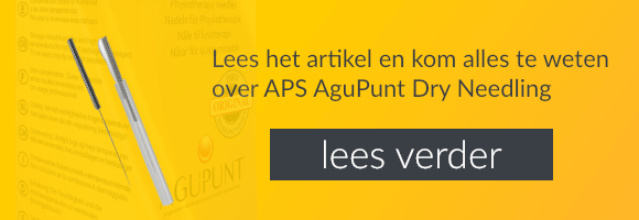 uitgelicht APS AguPunt