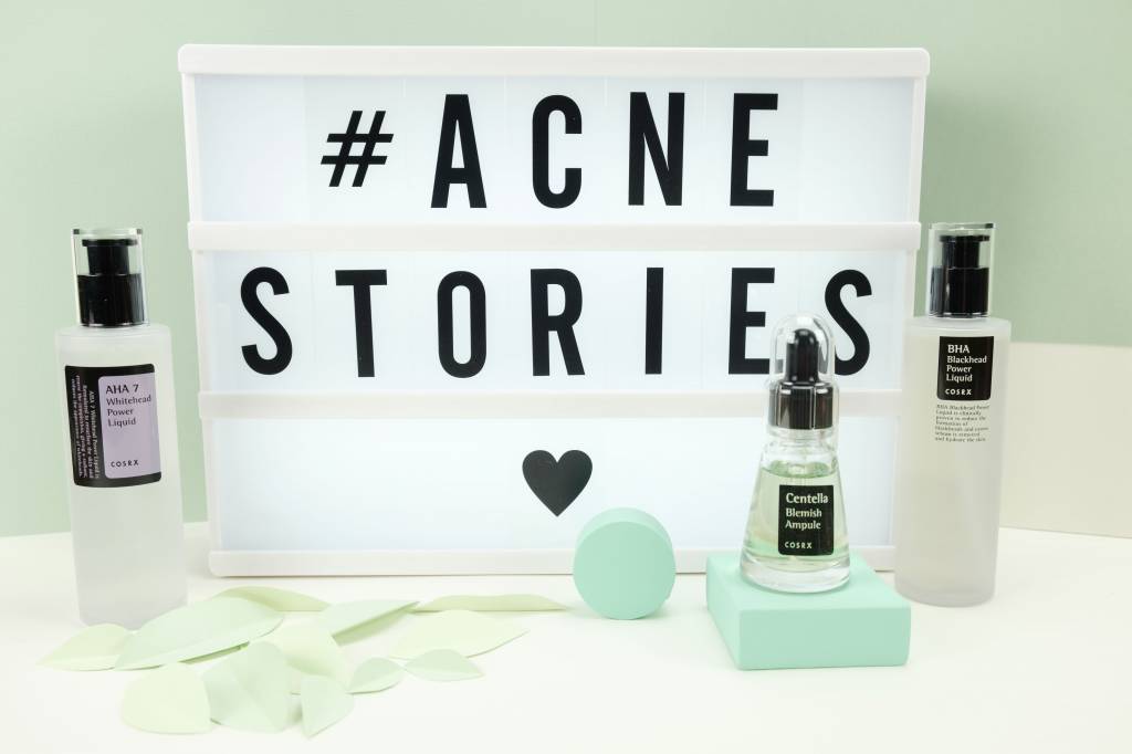 Acne stories - hoe kom je van je meeëters en onderhuidse puistjes af