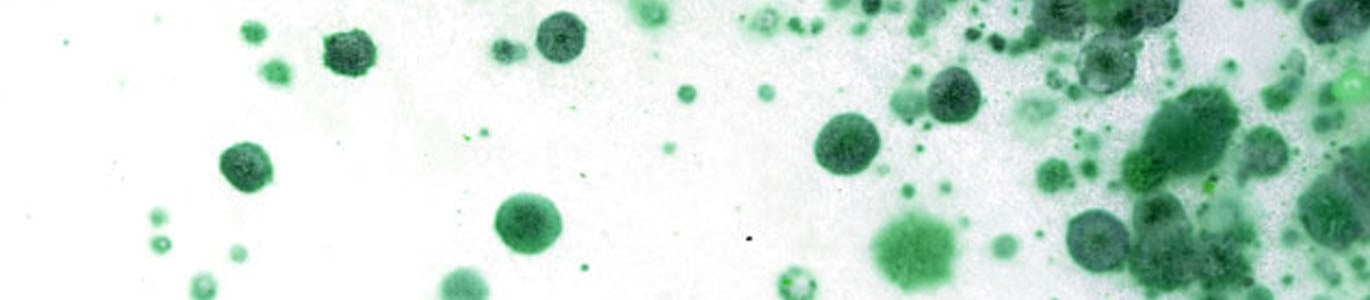 hongos y bacterias