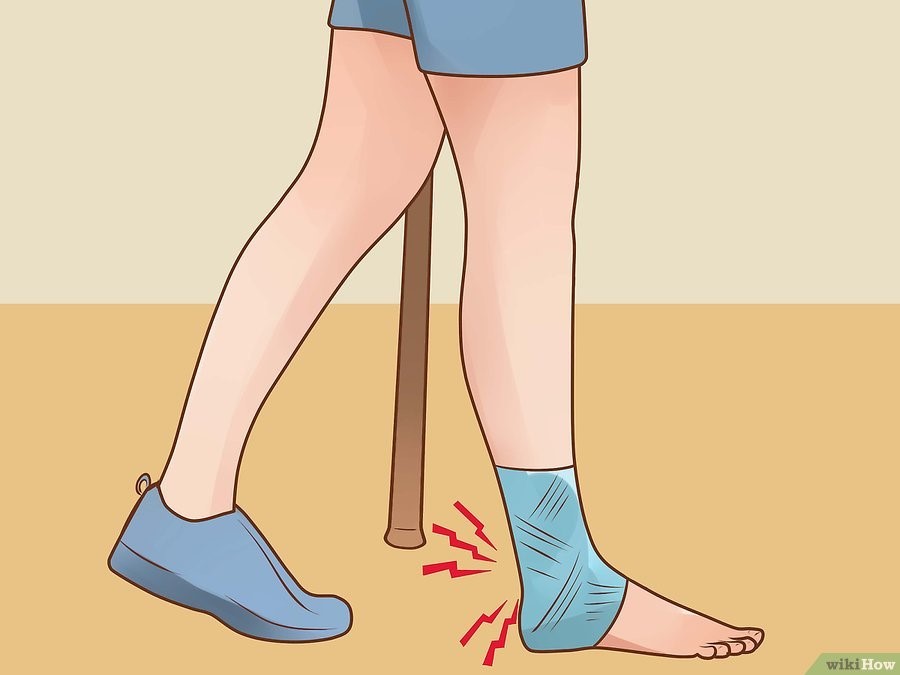Bad leg. Нога мультяшная. Костыли при переломе голеностопа. Трость для ходьбы после перелома лодыжки. Костыль нога.