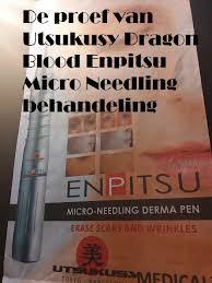 De proef van Utsukusy Dragon Blood enpitsu microneedling behandeling